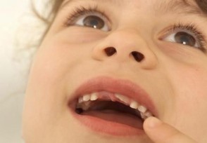 3岁娃日戴牙套12小时谁在贩卖焦虑 矫正牙齿越早越好吗