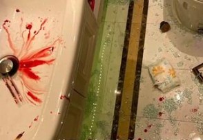 浴室房玻璃门爆裂男子受伤谁赔偿 缝了20多针